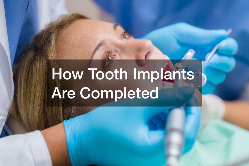 How Tooth Implants Are Completed